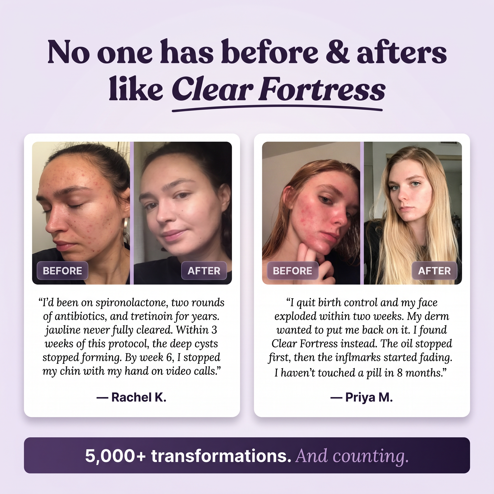 THE CLEAR FORTRESS™ - 3-Phase Acne Defense System