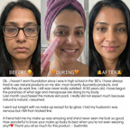 Volume Stick 5% Volufiline + PDRN Topical Volume Restoration