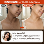 Peel Shot Kojic Acid Turmeric Spray
