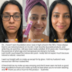 Volume Stick 5% Volufiline + PDRN Topical Volume Restoration